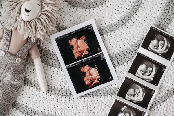 Ultrasound scan printouts and a knitted lion toy laid out on a crocheted blanket