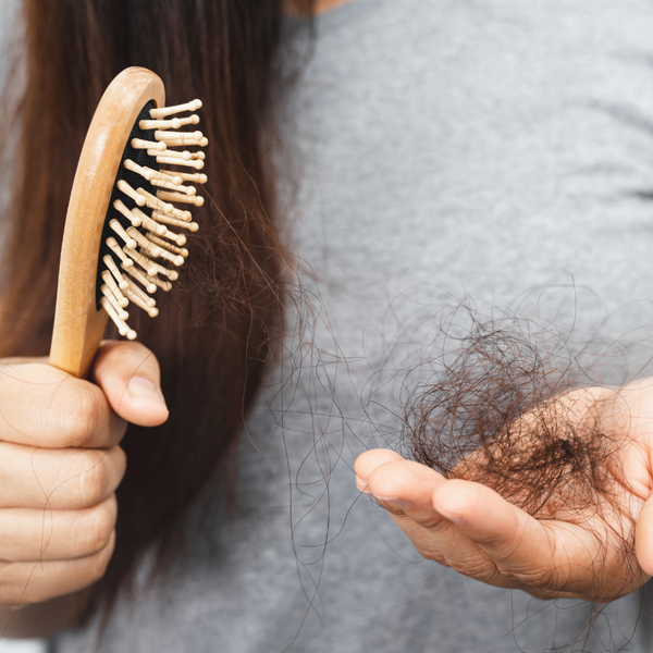 PCOS and Hair Loss
