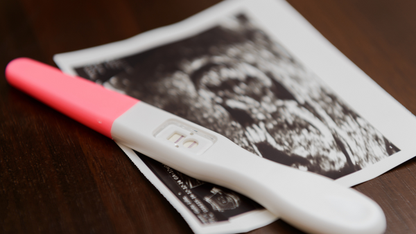 Pregnancy test resting on top of an ultrasound scan photo on a wooden table