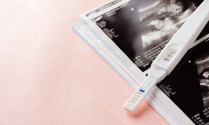 Ultrasound scan printouts with a pregnancy test showing a positive result resting on top