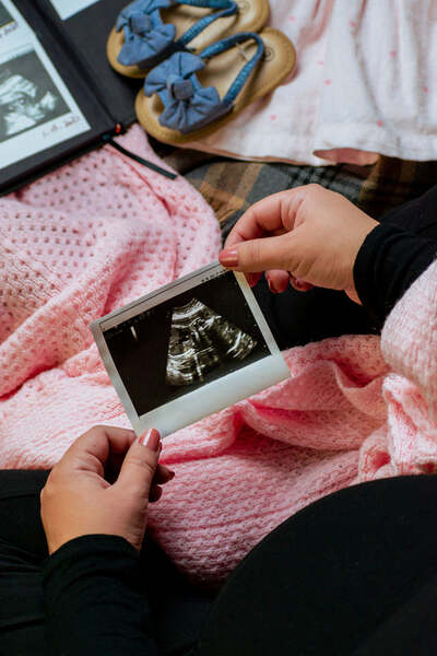 Close-up of hands holding a Polaroid-style ultrasound photo next to a baby album and blue baby shoes