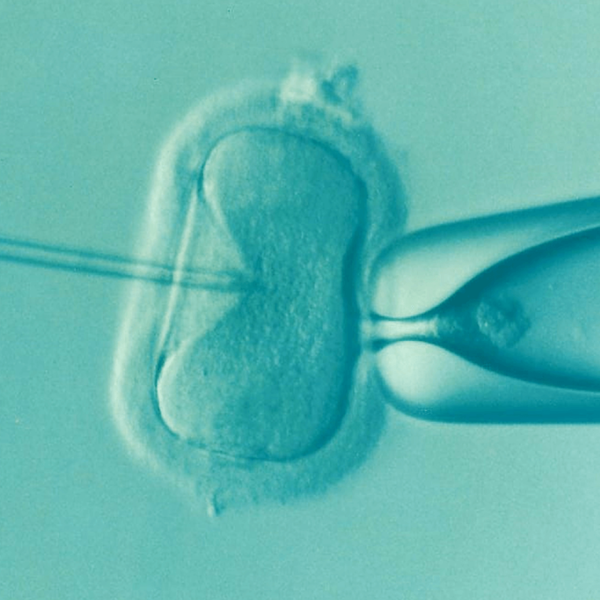 IVF under a microscope